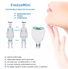 Yumind 360 grados Cryo Vacuum RF Eliminación de celulitis Máquina de adelgazamiento Congelación Cryolipolysis Grasa Pérdida de peso Body Shaping Beauty Equipment