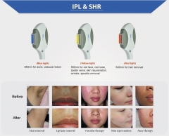 Máquina de belleza láser para depilación 3 en 1 DPL con RF y Pico Segundo estiramiento de la piel con láser para SPA